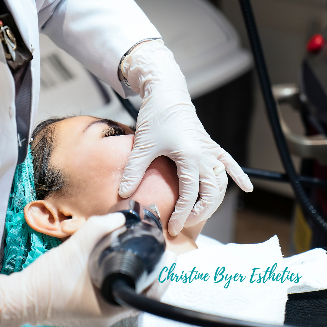 What is a Radiofrequency (RF) Treatment?