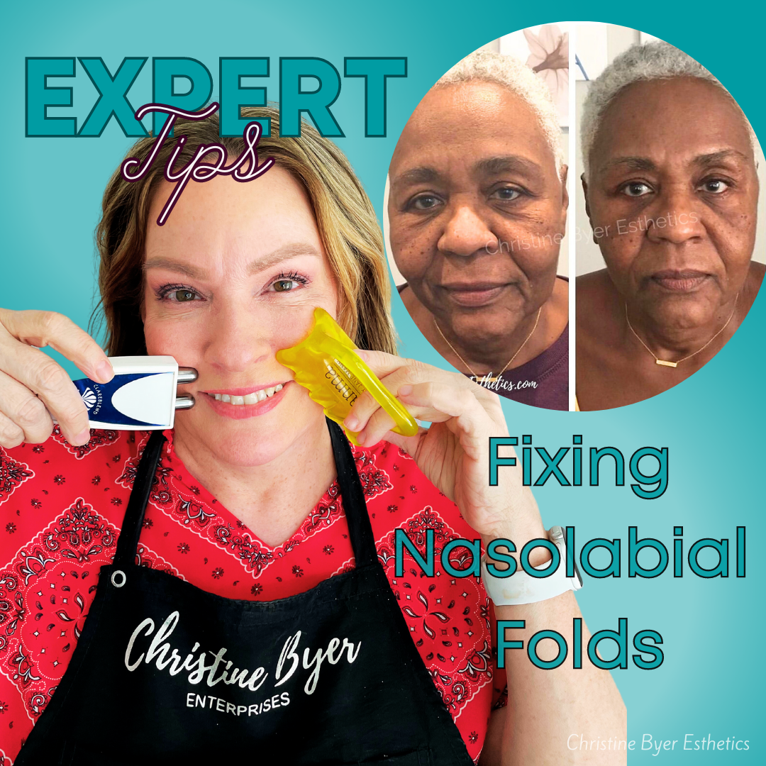 The Ultimate Guide to Fixing Nasolabial Folds – Christine Byer