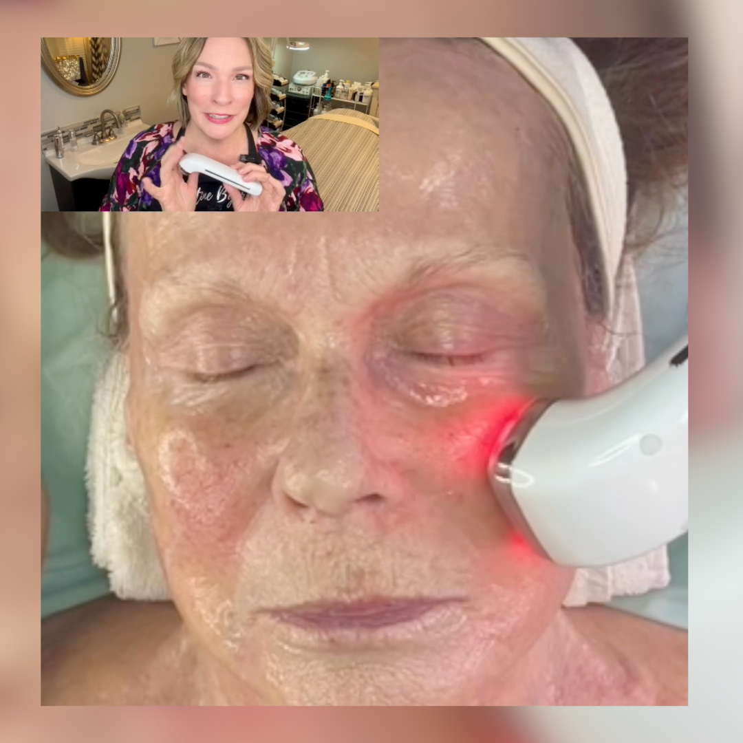 Game-Changing Radio Frequency Skincare Device for Skin Tightening