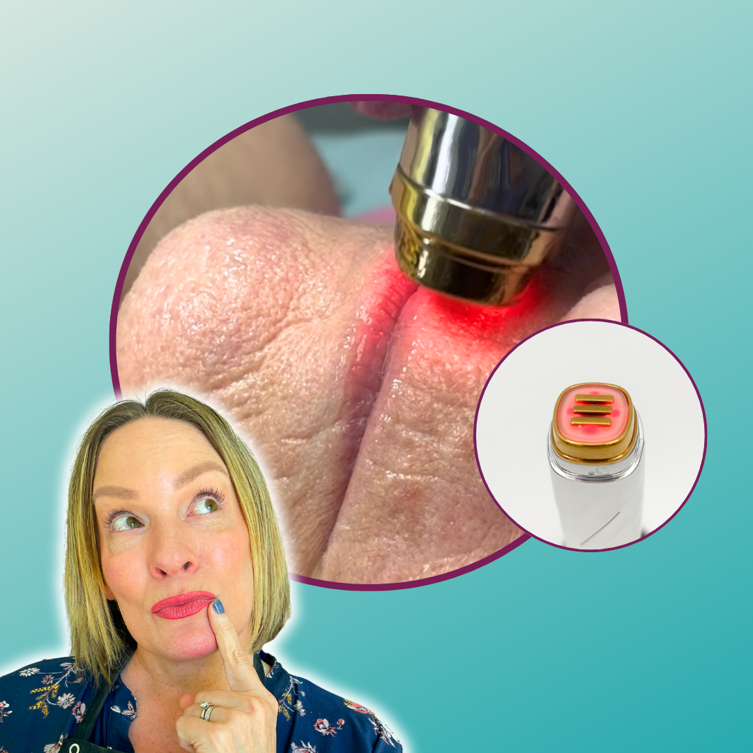 The Effective New Way to Smooth Vertical Lip Lines – Christine
