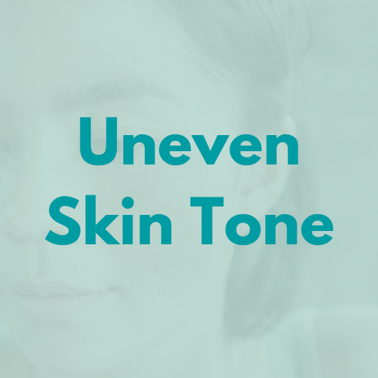 
    Uneven Skin Tone
  