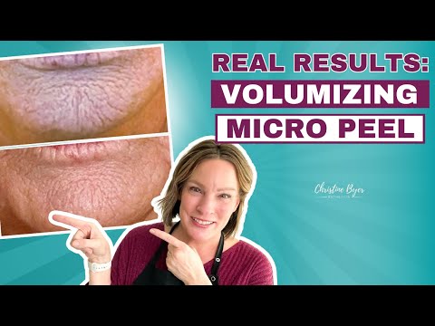 HOUSE OF PLLA® HOP+ Peel/24K Gold Volumizing Duo