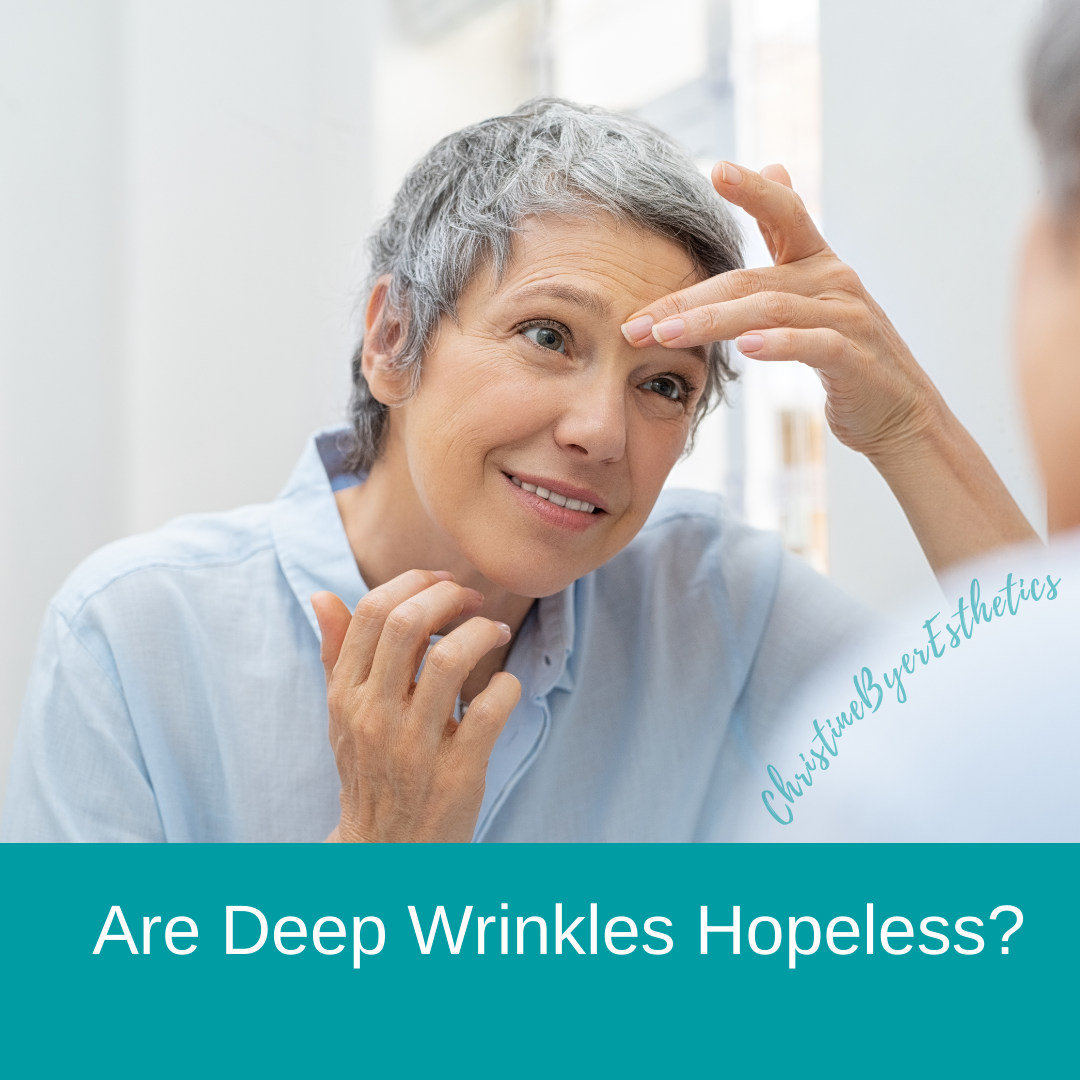 Are Deep Wrinkles Hopeless?