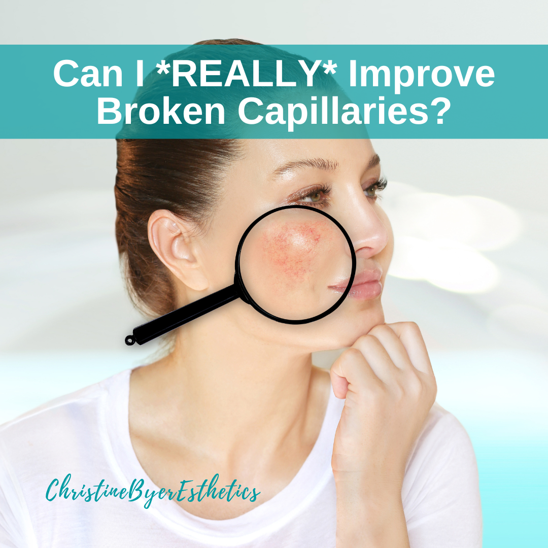Can I *REALLY* Improve Broken Capillaries?