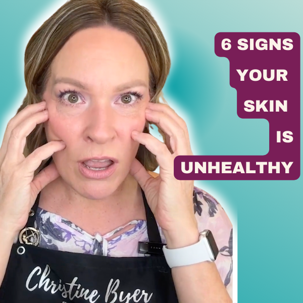 6 Signs Your Skin is Unhealthy (And How to Fix Them!)