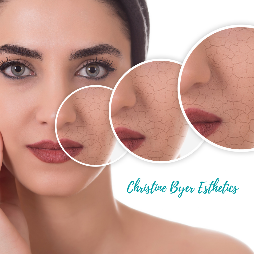 7 PRO Tips for Fall and Winter Skin