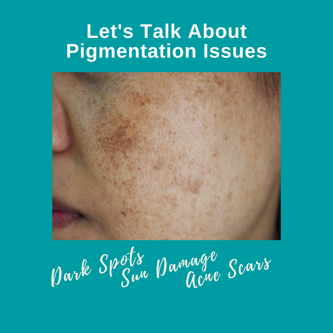 Let's Talk About Pigmentation Issues