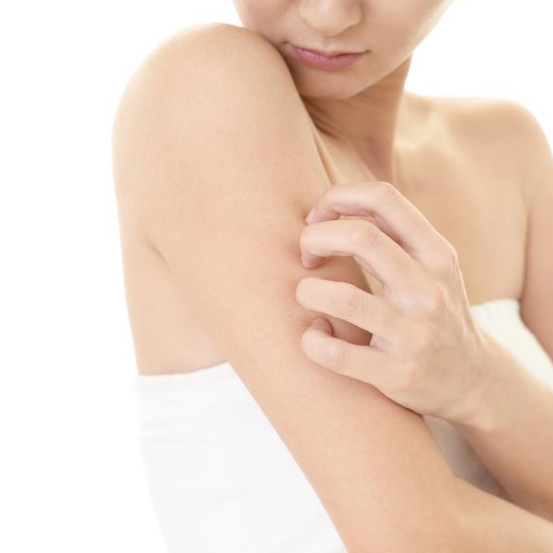 Conquer Eczema with this Treatment Protocol