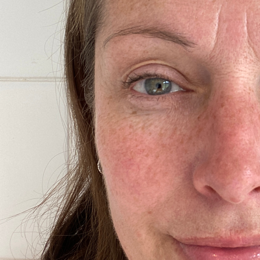 Burnt Out by Your Skincare Routine? Simple Menopause Skin Reset