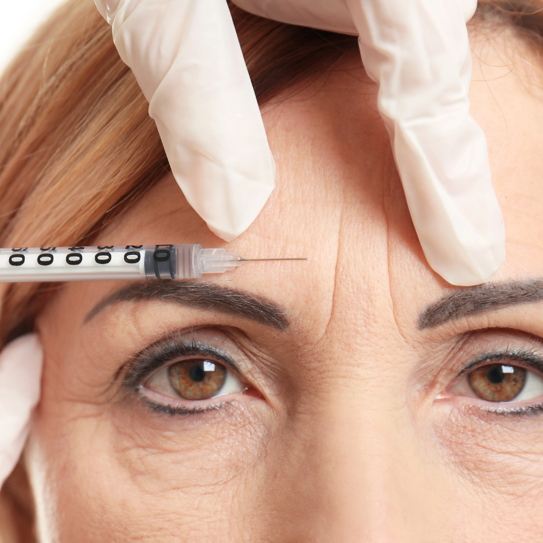 PLLA Facial Filler vs. Topical Use: Are PLLA Injections Safe ...