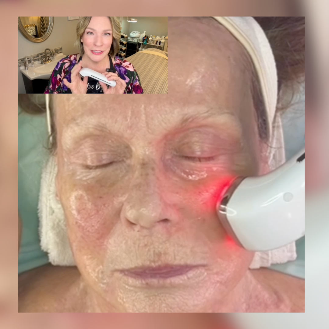 The Ultimate Radio Frequency Skincare Device For Skin Tightening