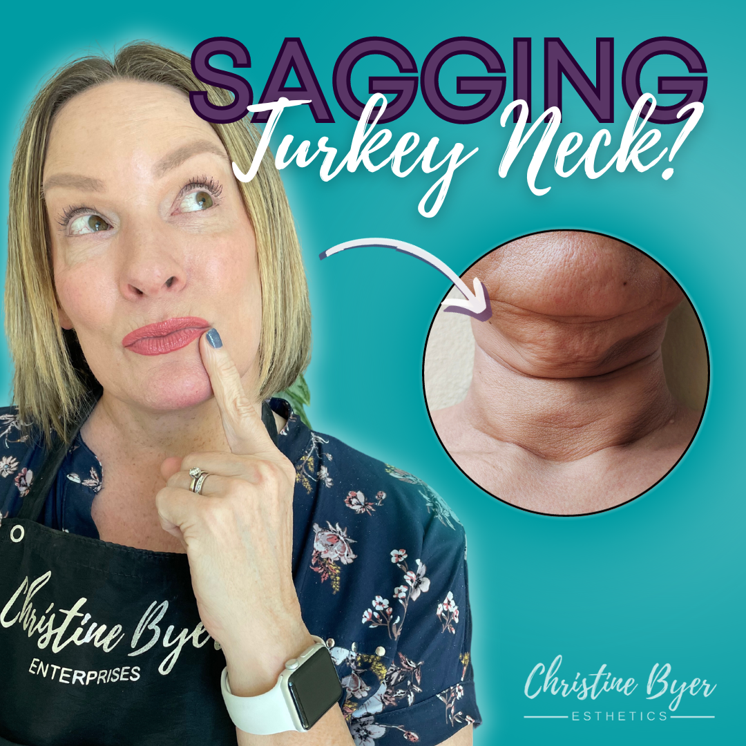 How to Fix a “Turkey” Neck