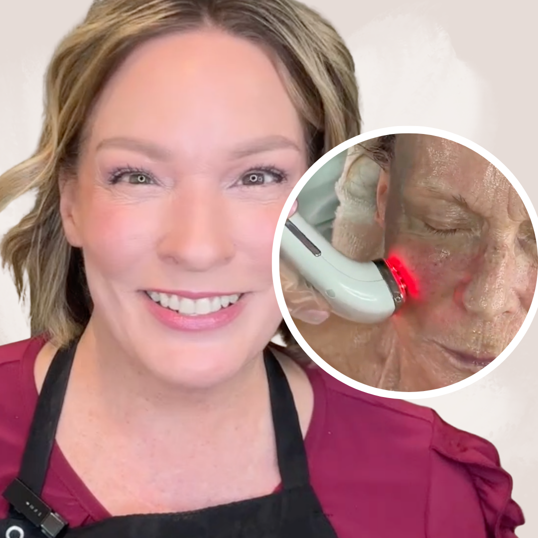 XERF ALTERNATIVES: How to Energize Skin and Tighten Dermal Tissue At Home