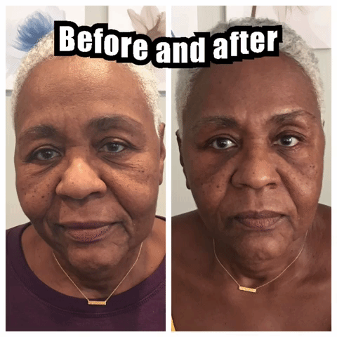 Massage.  How antiaging is it?