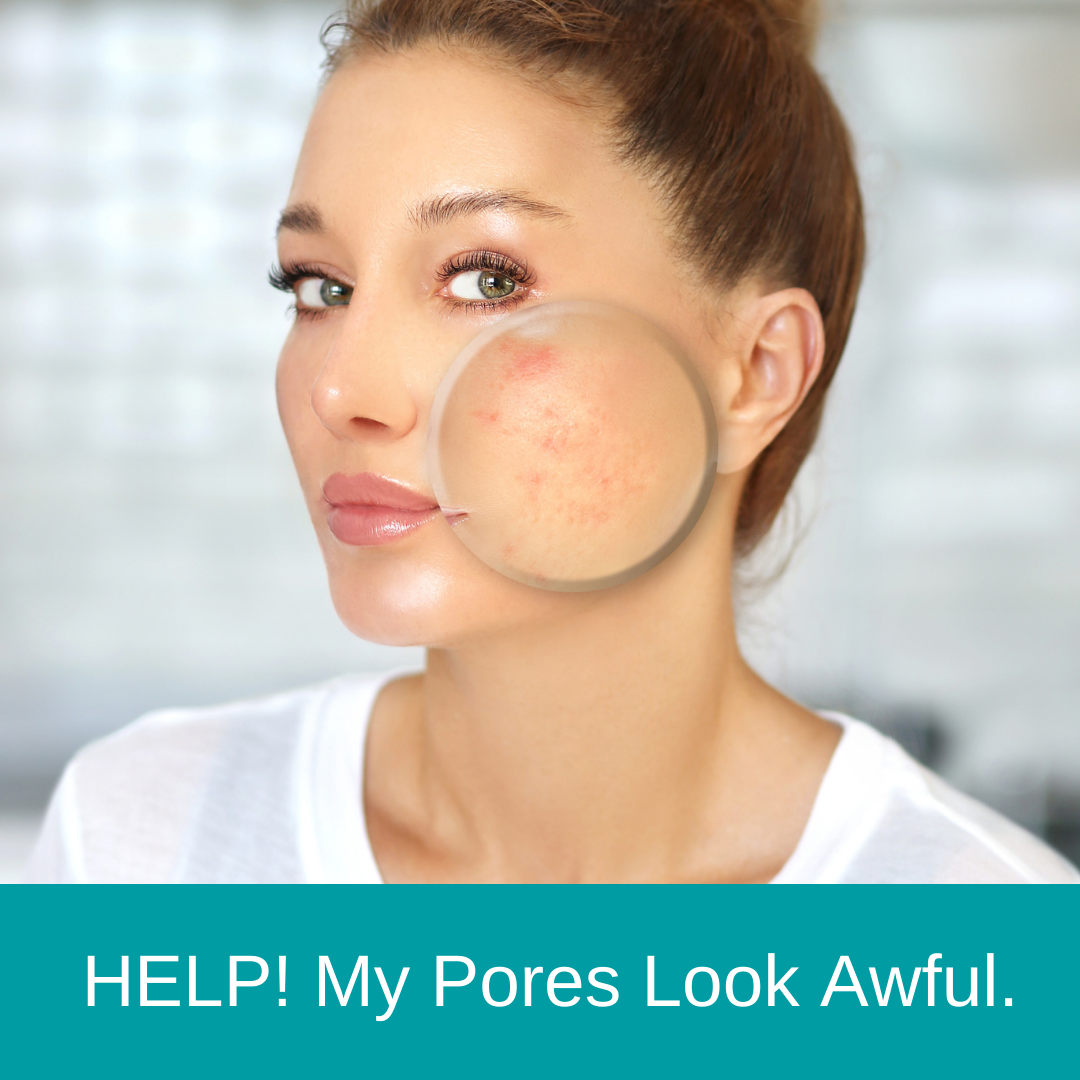 Help! My Pores Look Awful.