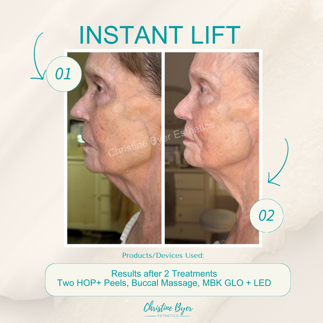 MBK Glo Lift and Sculpt