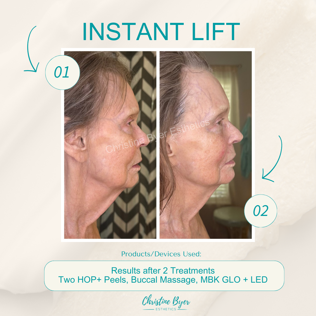 MBK Glo Lift and Sculpt