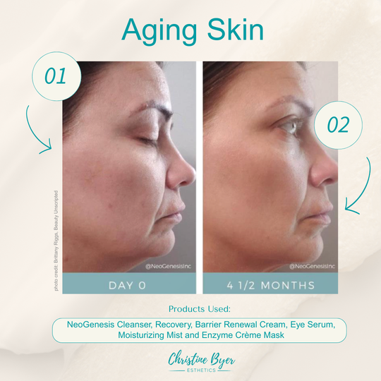 NeoGenesis – Christine Byer Esthetics