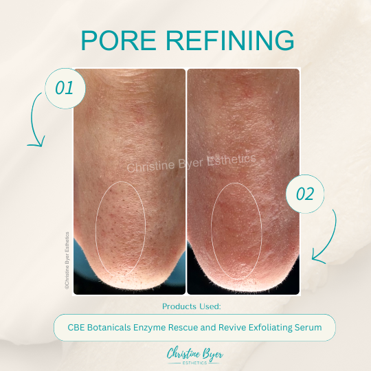 Pore Refining System