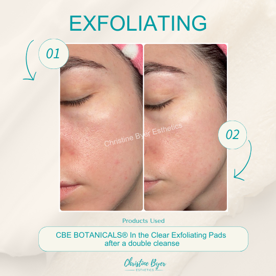 CBE Botanicals In the Clear - Mandelic Acid Exfoliating Pads