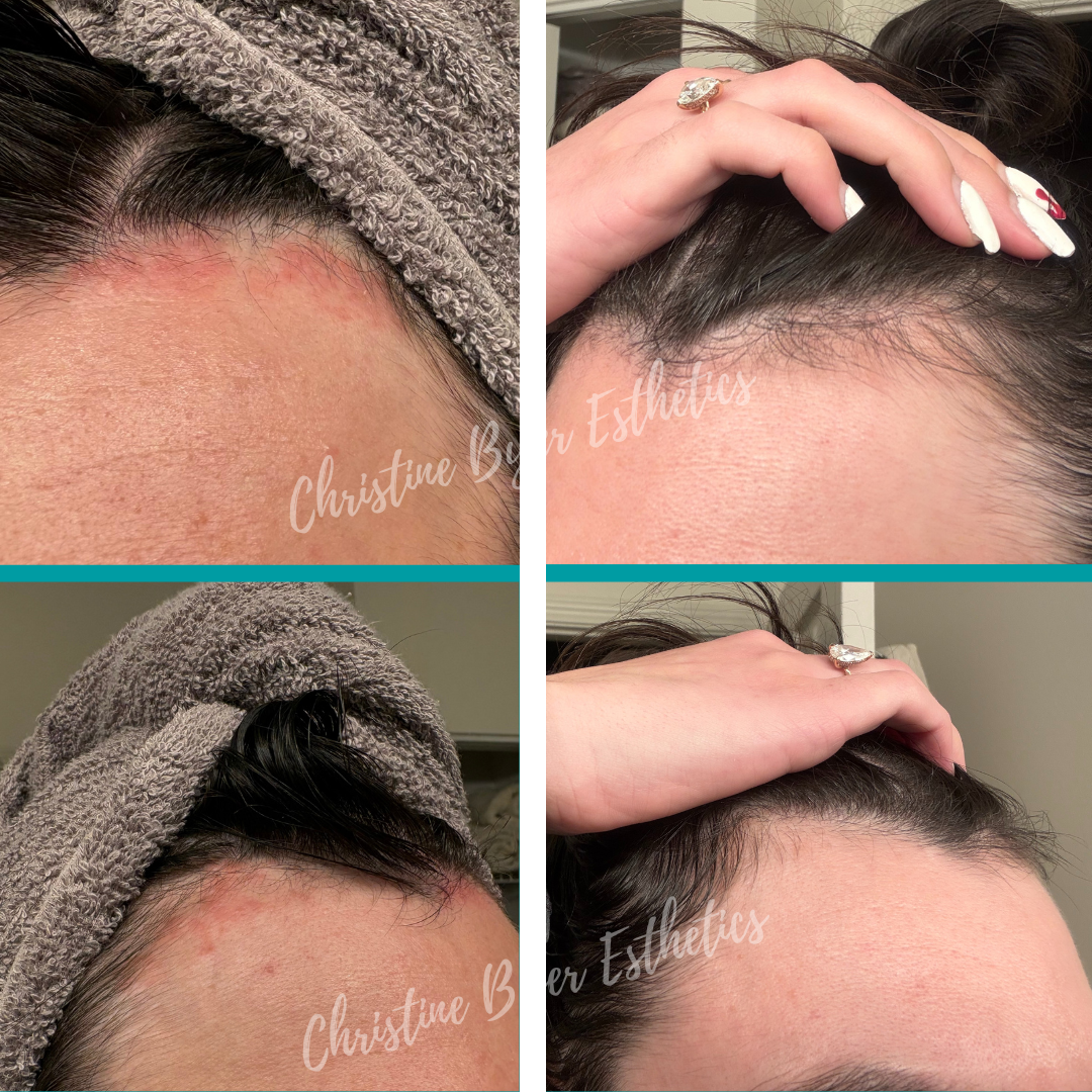 NeoGenesis MB-2 Probiotic Balm