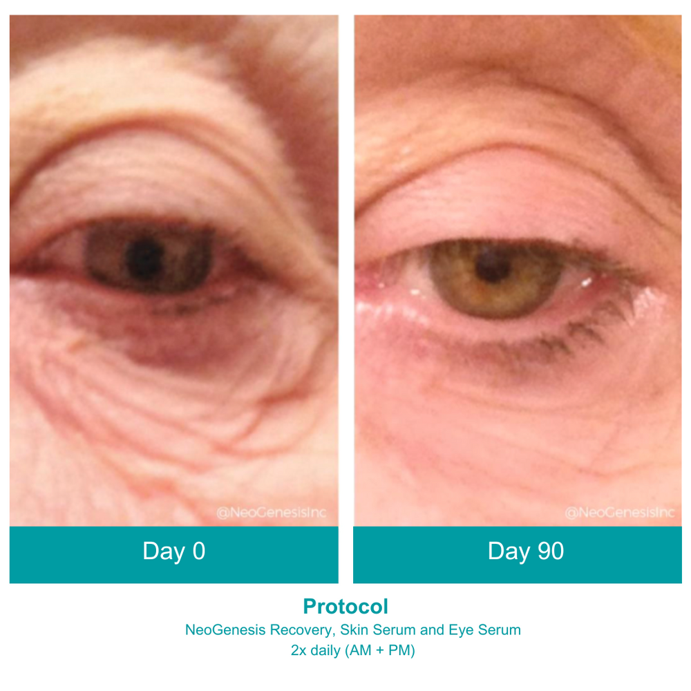 NeoGenesis Eye Serum - 10mL