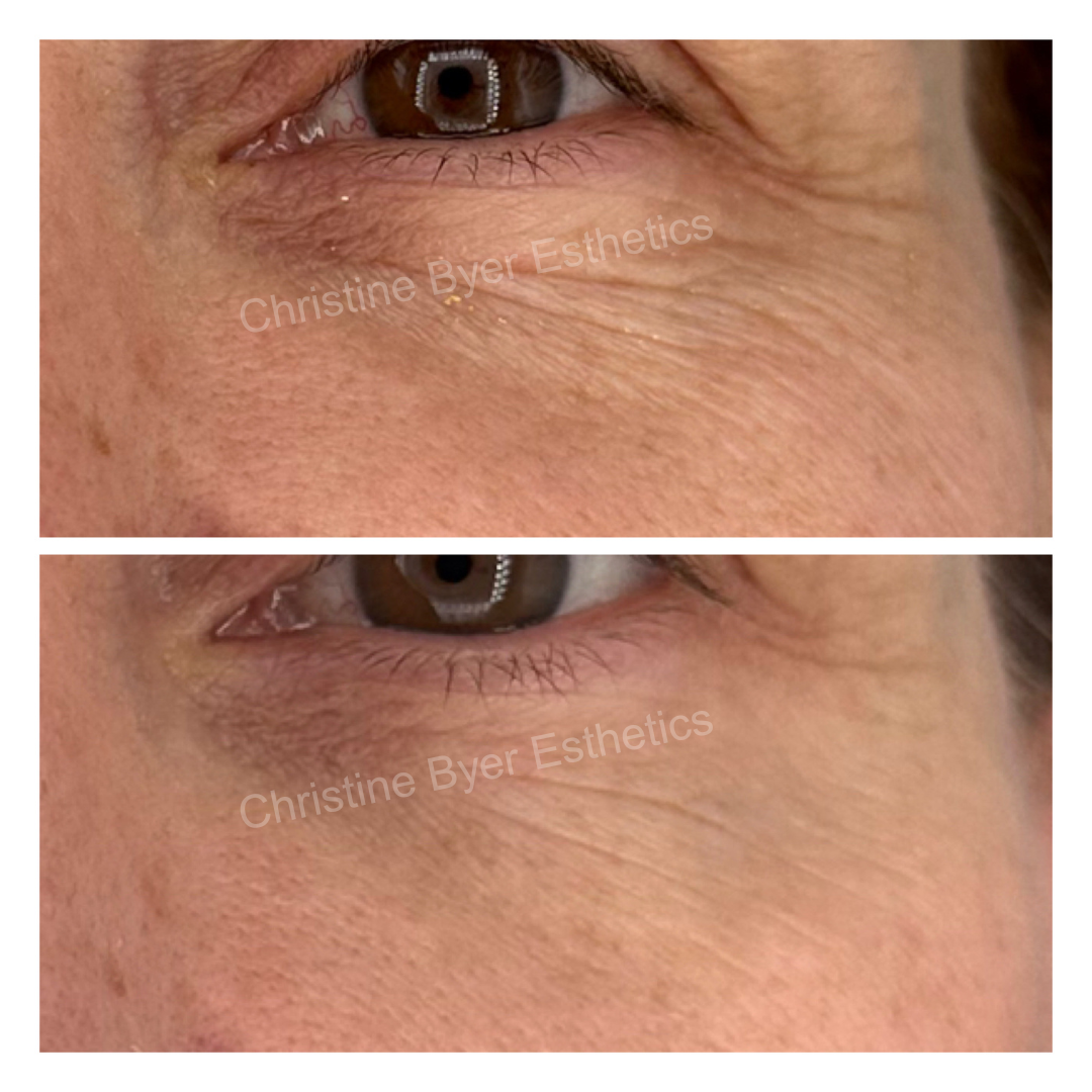 HOUSE OF PLLA® HOP+ CAVIPLLA+O2® Advanced Volumizing Serum HOUSE OF PLLA® HOP+ CAVIPLLA+O2® Advanced Volumizing Serum