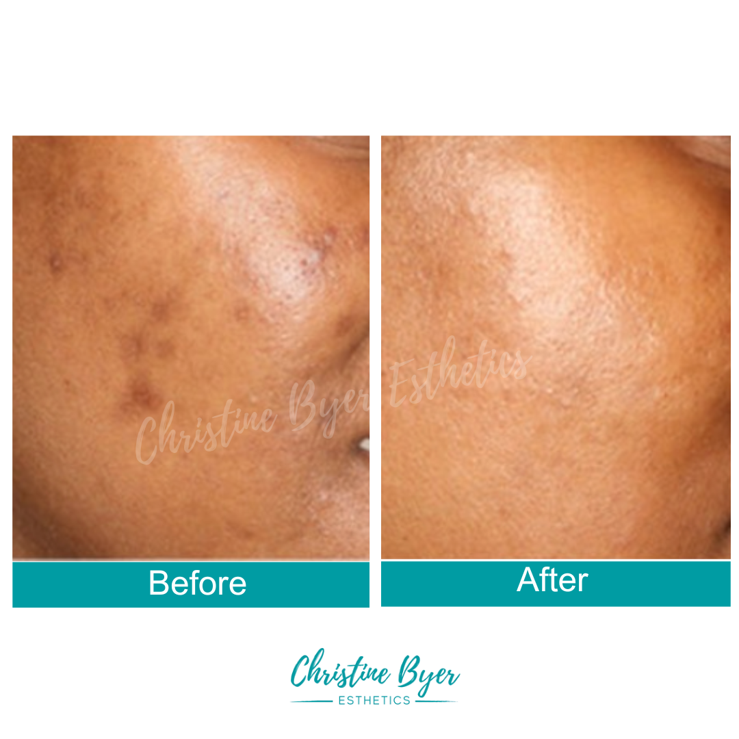 CBE Botanicals Triple C + Gold Serum