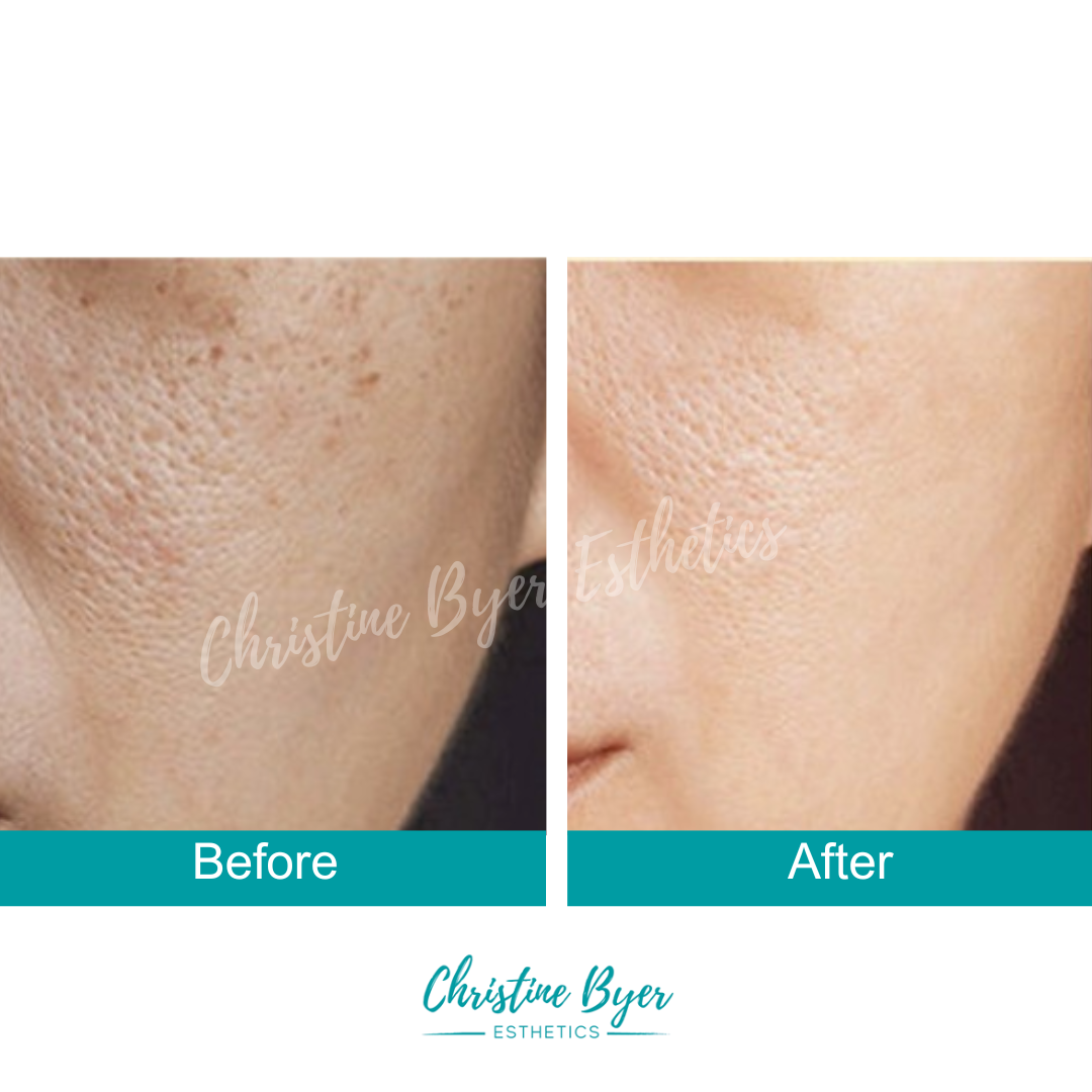 CBE Botanicals Triple C + Gold Serum