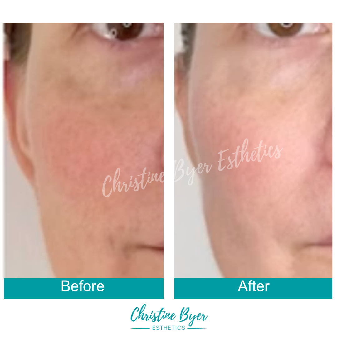 CBE Botanicals Triple C + Gold Serum