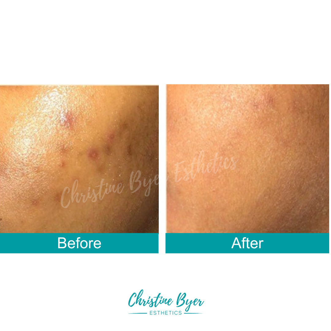 CBE Botanicals Triple C + Gold Serum