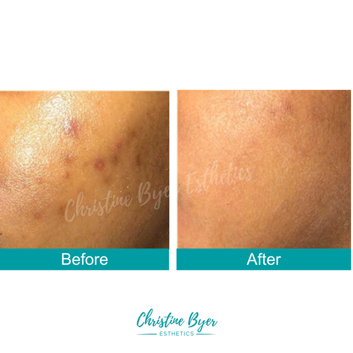 CBE Botanicals Triple C + Gold Serum