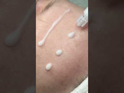 Volume Boost Spicule Eye Program